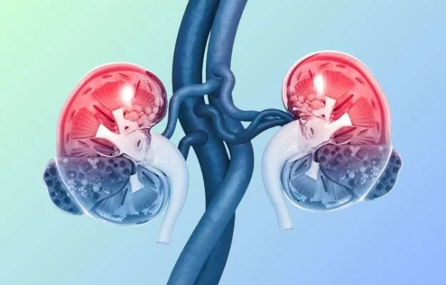 Acute kidney injury (AKI) treatment in Hyderabad by Dr. Ramesh Vasa