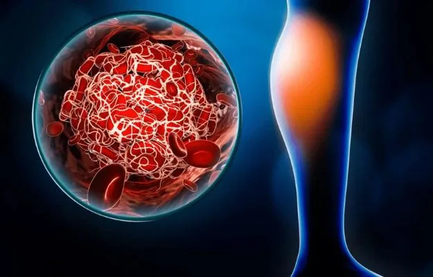 Autoimmune-Related Kidney Diseases (SLE, Vasculitis) in Hyderabad