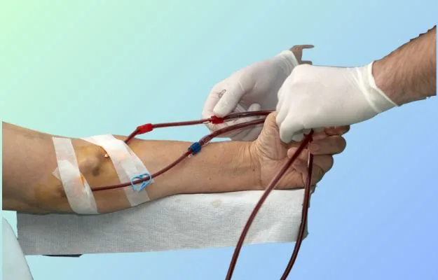 Hemodialysis treatment in Hyderabad by Dr. Ramesh Vasa