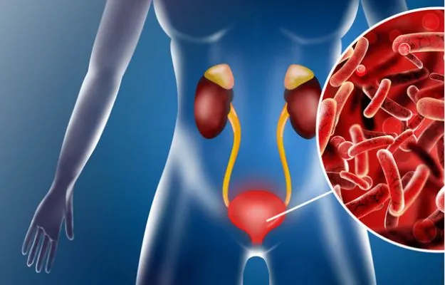 Urinary tract infections and recurrent UTI treatment in Hyderabad